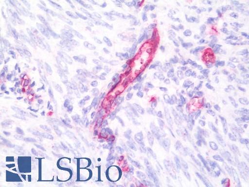 Anti-ATP5D antibody IHC staining of human uterus, endometrium. Immunohistochemistry of formalin-fixed, paraffin-embedded tissue after heat-induced antigen retrieval. Antibody LS-B10648 concentration 10 ug/ml.