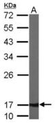 Sample (50 ug of whole cell lysate). A: Mouse brain. 12% SDS PAGE. ATP5D antibody diluted at 1:1000.