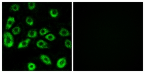 Immunofluorescence of A549 cells, using ATP5D Antibody. The picture on the right is treated with the synthesized peptide.