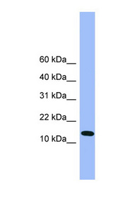 ATP5D antibody LS-C135378 Western blot of Mouse Liver lysate.