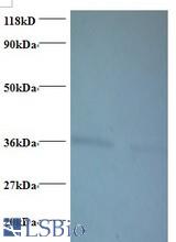 Western blot of ATP synthase subunit delta, mitochondrial antibody at 2 ug/ml. Lane 1: EC109 whole cell lysate. Lane 2: 293T whole cell lysate. Secondary: Goat polyclonal to Rabbit IgG at 1:15000 dilution. Predicted band size: 18.5 kDa. Observed band size: 36 kDa.