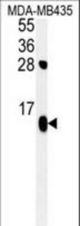 ATP5D Antibody western blot of MDA-MB435 cell line lysates (35 ug/lane). The ATP5D antibody detected the ATP5D protein (arrow).