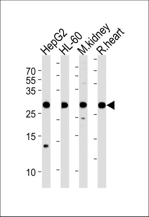 ATP5F1 Antibody western blot of HepG2, HL-60 cell line, mouse kidney and rat heart tissue lysates (35 ug/lane). The ATP5F1 antibody detected the ATP5F1 protein (arrow).