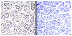 IHC of paraffin-embedded human pancreas tissue, using ATP5G3 Antibody. The picture on the right is treated with the synthesized peptide.