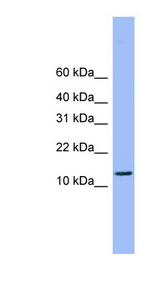ATP5H antibody LS-C116916 Western blot of MCF7 cell lysate.