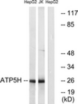 Western blot of extracts from HepG2/Jurkat cells, using ATP5H Antibody. The lane on the right is treated with the synthesized peptide.