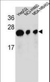 ATP5H Antibody western blot of HepG2,NCI-H460,MDA-MB453 cell line lysates (35 ug/lane). The ATP5H antibody detected the ATP5H protein (arrow).