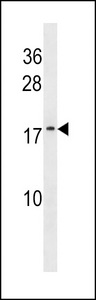 ATP5L2 Antibody western blot of WiDr cell line lysates (35 ug/lane). The ATP5L2 antibody detected the ATP5L2 protein (arrow).