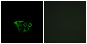 Immunofluorescence of A549 cells, using ATP5L2 Antibody. The picture on the right is treated with the synthesized peptide.