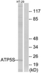 Western blot of extracts from HT-29 cells, using ATP5S Antibody. The lane on the right is treated with the synthesized peptide.