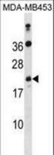 ATP5S Antibody western blot of MDA-MB453 cell line lysates (35 ug/lane). The ATP5S antibody detected the ATP5S protein (arrow).