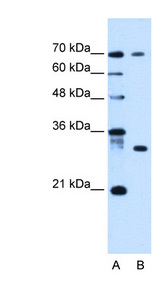 ATP6AP1L antibody LS-C40496 Western blot of HepG2 cell lysate.