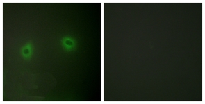 Immunofluorescence of HeLa cells, using Caper Antibody. The picture on the right is treated with the synthesized peptide.