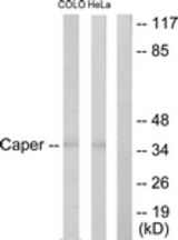 Western blot of extracts from COLO205/HeLa cells, using Caper Antibody. The lane on the right is treated with the synthesized peptide.