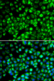 Immunofluorescence blot of HeLa cell using ATP6AP2 antibody. Blue: DAPI for nuclear staining.