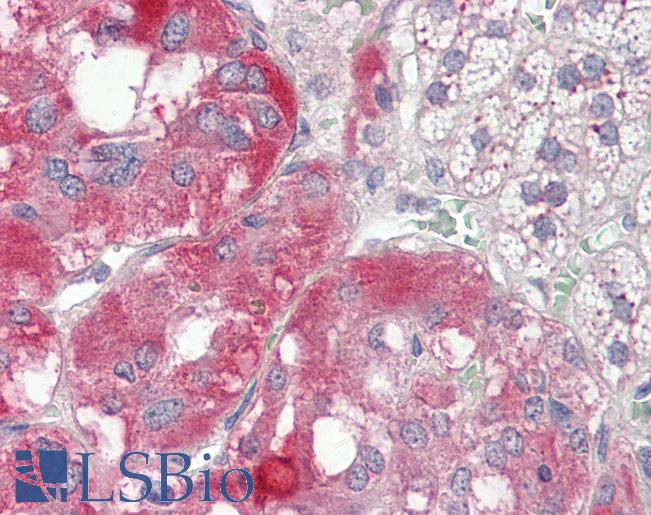 Human Adrenal: Formalin-Fixed, Paraffin-Embedded (FFPE)