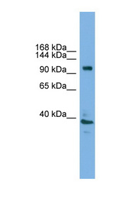 ATP6V0A1 antibody LS-C116071 Western blot of Mouse Uterus lysate.