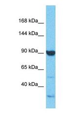Western blot of ATP6V0A2 Antibody with human A549 Whole Cell lysate.