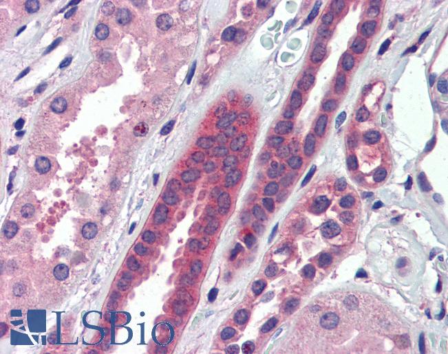 Anti-ATP6V0A2 antibody IHC of human kidney. Immunohistochemistry of formalin-fixed, paraffin-embedded tissue after heat-induced antigen retrieval. Antibody LS-B3548 concentration 5 ug/ml.