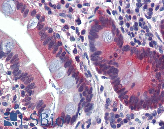 Anti-ATP6V0A2 antibody IHC of human small intestine. Immunohistochemistry of formalin-fixed, paraffin-embedded tissue after heat-induced antigen retrieval. Antibody LS-B3548 concentration 5 ug/ml.