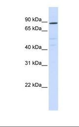 Hela cell lysate. Antibody concentration: 1.0 ug/ml. Gel concentration: 12%.