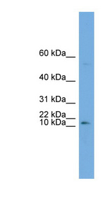ATP6V0C antibody LS-C111009 Western blot of OVCAR-3 cell lysate.