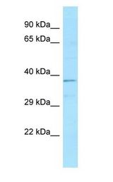 ATP6V0D1 antibody Western Blot of Fetal kidney.