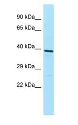 ATP6V0D1 antibody Western Blot of HeLa.