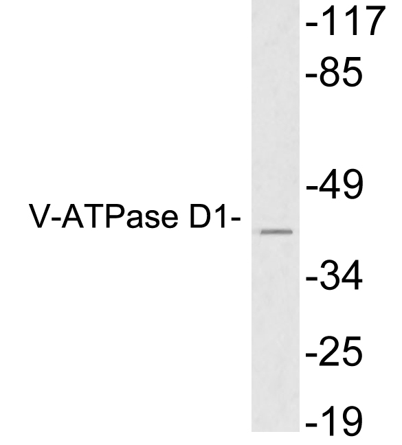 Western blot of extracts from HeLa cells, using V-ATPase D1 antibody.