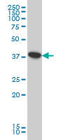 ATP6V0D1 monoclonal antibody (M01), clone 2G12 Western blot of ATP6V0D1 expression in HeLa.