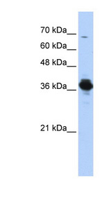 ATP6V0D2 antibody LS-C111657 Western blot of Transfected 293T cell lysate.