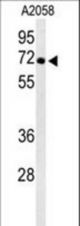 Western blot of ATP6V1A Antibody in A2058 cell line lysates (35 ug/lane). ATP6V1A (arrow) was detected using the purified antibody.