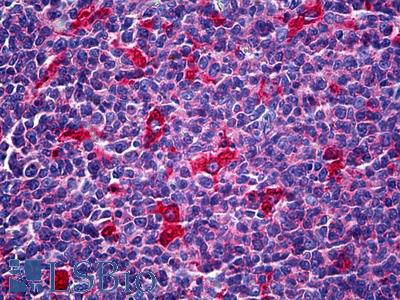Anti-ATP6V1A antibody IHC of human tonsil. Immunohistochemistry of formalin-fixed, paraffin-embedded tissue after heat-induced antigen retrieval. Antibody LS-B5930 concentration 5 ug/ml.