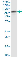 ATP6V1A monoclonal antibody, clone 4F5. Western blot of ATP6V1A expression in human kidney.