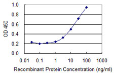 Detection limit for recombinant GST tagged ATP6V1B1 is 0.3 ng/ml as a capture antibody.