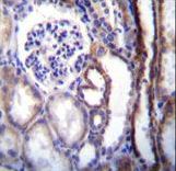 ATP6V1B1 Antibody immunohistochemistry of formalin-fixed and paraffin-embedded human kidney tissue followed by peroxidase-conjugated secondary antibody and DAB staining.