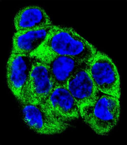 Confocal immunofluorescent of ATP6V1B1 Antibody with WiDr cell followed by Alexa Fluor 488-conjugated goat anti-rabbit lgG (green). DAPI was used to stain the cell nuclear (blue).