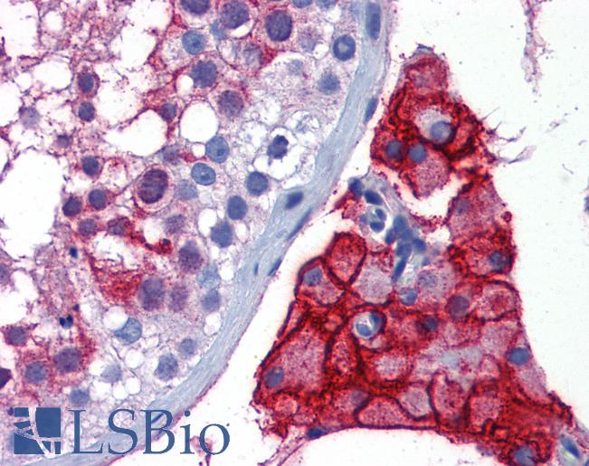 Anti-ACE-2 antibody IHC of human testis. Immunohistochemistry of formalin-fixed, paraffin-embedded tissue after heat-induced antigen retrieval. Antibody LS-B5837 concentration 5 ug/ml.
