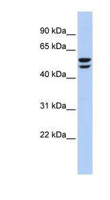ATP6V1B2 antibody LS-C111881 Western blot of 721_B cell lysate.