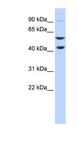 ATP6V1B2 antibody LS-C111882 Western blot of HeLa lysate.