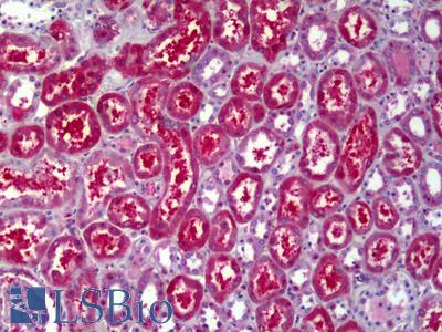 Anti-ATP6V1B2 antibody IHC of human kidney, tubules. Immunohistochemistry of formalin-fixed, paraffin-embedded tissue after heat-induced antigen retrieval. Antibody LS-B6383 concentration 5 ug/ml.
