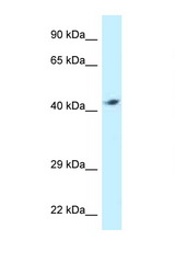 ATP6V1C2 antibody LS-C145785 Western blot of MCF7 Cell lysate. Antibody concentration 1 ug/ml.