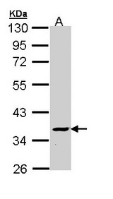 Sample (30 ug of whole cell lysate). A: Molt-4 . 10% SDS PAGE. ATP6V1C2 antibody diluted at 1:1000.