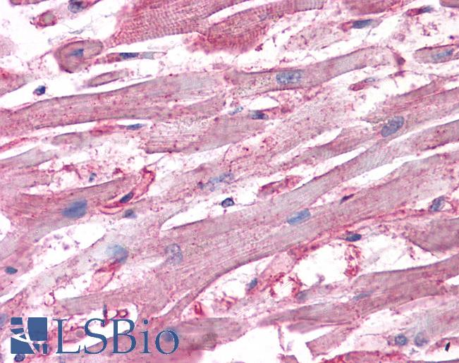Anti-ATP6V1D antibody IHC of human heart. Immunohistochemistry of formalin-fixed, paraffin-embedded tissue after heat-induced antigen retrieval. Antibody LS-B4526 concentration 2.5 ug/ml.