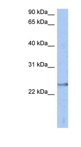 ATP6V1E2 antibody LS-C112216 Western blot of Fetal Spleen lysate.