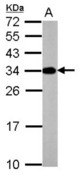 Sample (50 ug of whole cell lysate) A: mouse brain 12% SDS PAGE ATP6V1E2 antibody diluted at 1:10000