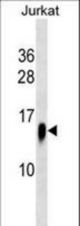ATP6V1F Antibody western blot of Jurkat cell line lysates (35 ug/lane). The ATP6V1F antibody detected the ATP6V1F protein (arrow).
