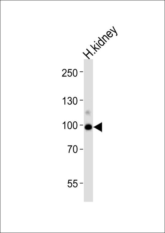 Western blot of lysate from human kidney tissue lysate, using ACE2(SARS-R) Antibody (S155). Antibody was diluted at 1:1000 at each lane. A goat anti-rabbit IgG H&L (HRP) at 1:5000 dilution was used as the secondary antibody. Lysate at 35ug per lane.