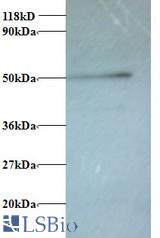 Western blot of V-type proton ATPase subunit G 1 antibody at 2 ug/ml + 293T whole cell lysate at 20 ug. Secondary: Goat polyclonal to Rabbit IgG at 1:15000 dilution. Predicted band size: 13 kDa. Observed band size: 50 kDa.