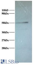 Western blot of V-type proton ATPase subunit G 1 Antibody at 2 ug/ml + 293T whole cell lysate at 20 ug. Secondary: Goat polyclonal to Rabbit IgG at 1:15000 dilution. Predicted band size: 13 kDa. Observed band size: 50 kDa.
